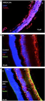 Oct4 Methylation-Mediated Silencing As an Epigenetic Barrier Preventing Müller Glia Dedifferentiation in a Murine Model of Retinal Injury